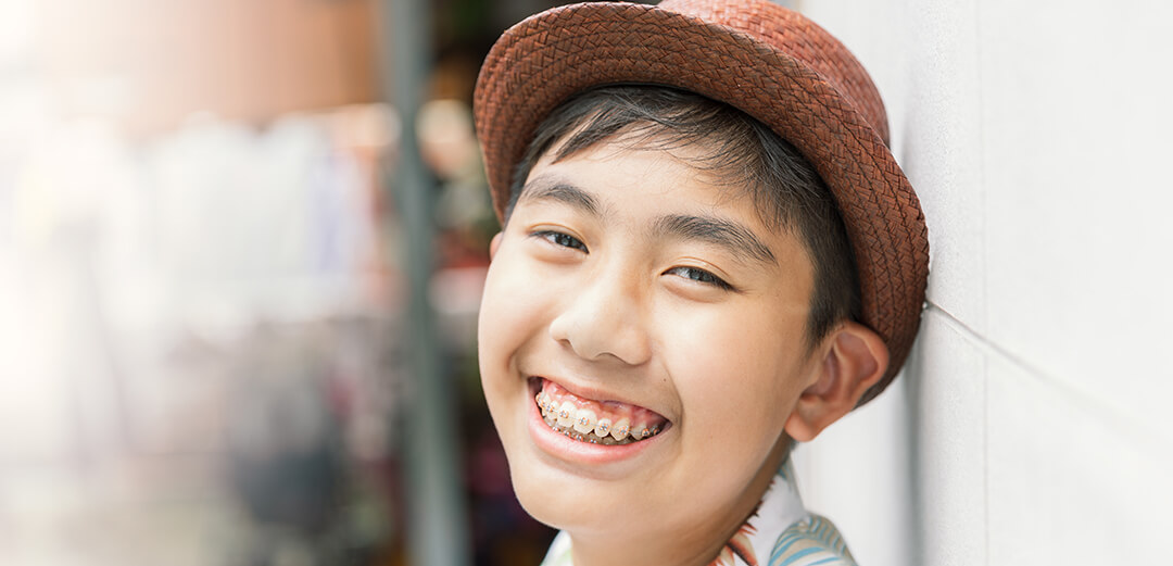 The Benefits Of Fixed Retainers