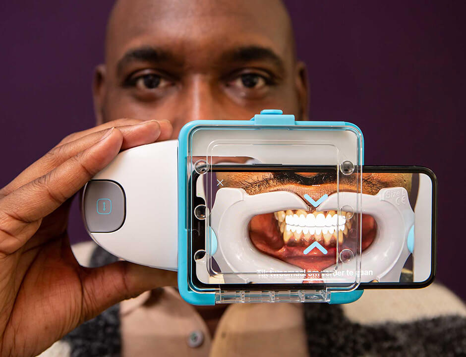What is Dental Monitoring? What is Dental Monitoring?