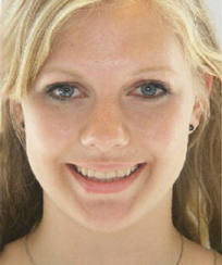 Face After Face After