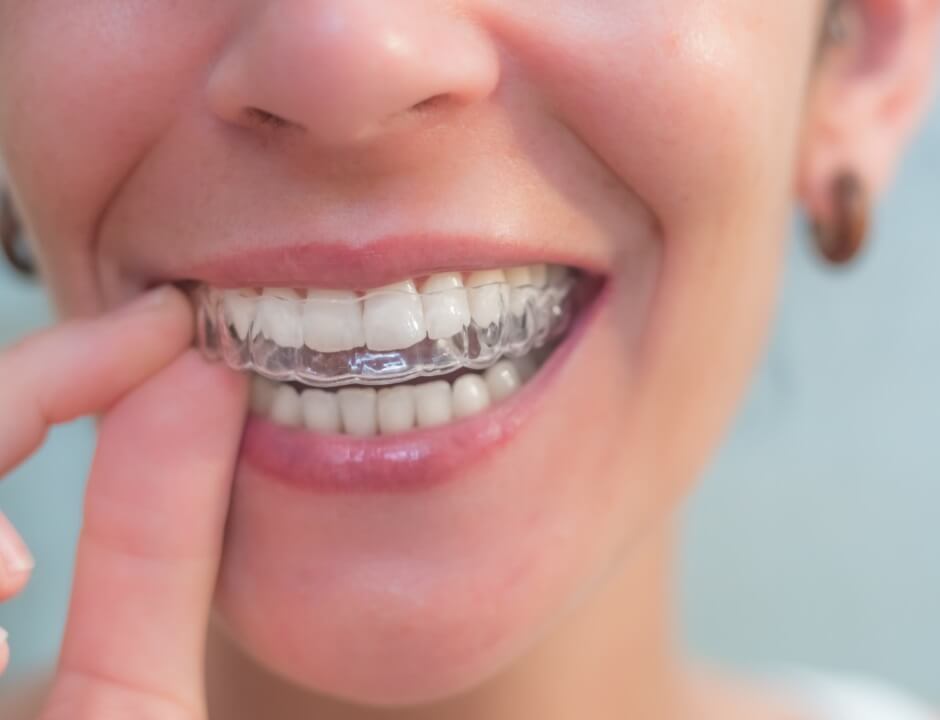 Looking Retainers Looking Retainers